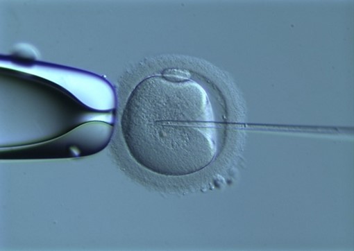 IVF/ICSI Treatment | The Hewitt Fertility Centre